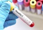 Afirman que "es el mejor momento" para curar la hepatitis C