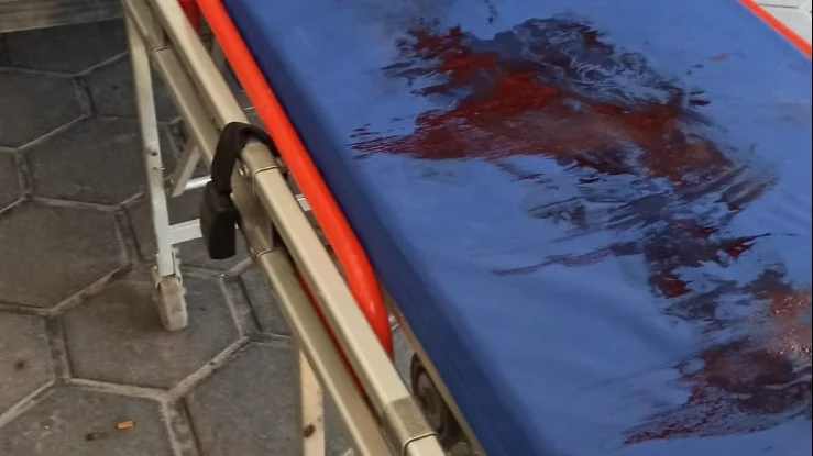 Un joven resultó baleado esta mañana, a la salida de una fiesta