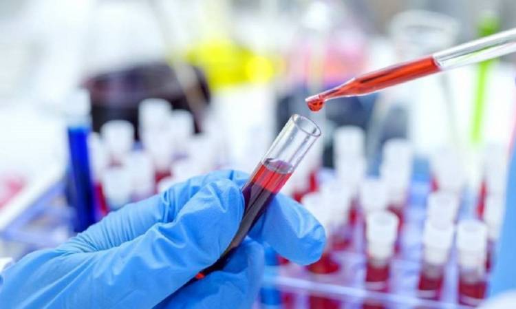 Confirman otro caso de cura de VIH: por qué el nuevo “paciente Berlín” despierta esperanzas en la lucha contra el sida